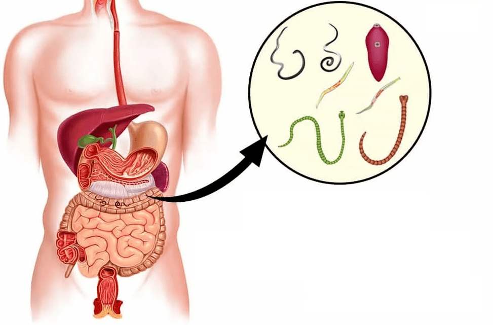 Helmintos y gusanos en el tracto gastrointestinal. 