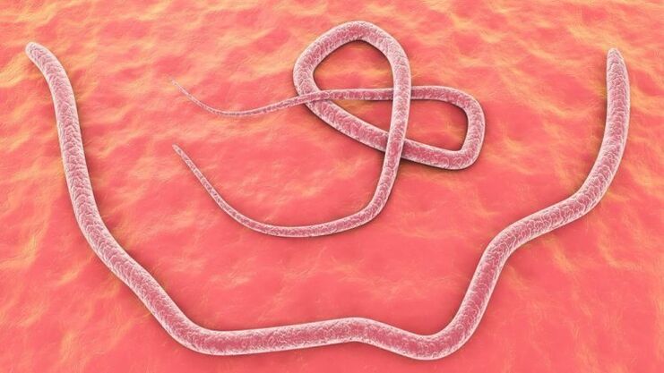 lombrices intestinales en el cuerpo humano