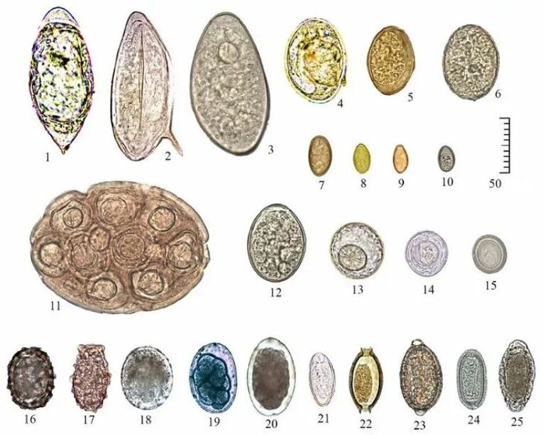 Forma y tamaño de huevos de diferentes helmintos.