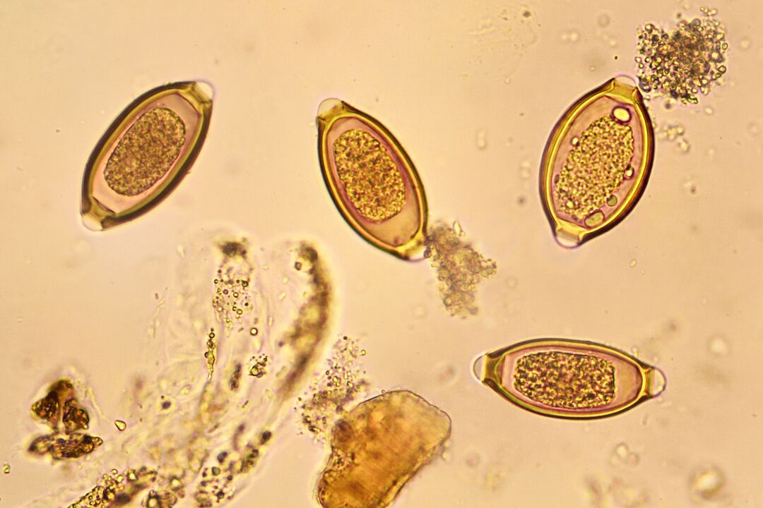 gusanos en el cuerpo humano