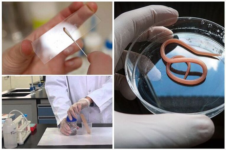 pruebas para detectar la presencia de gusanos en el cuerpo