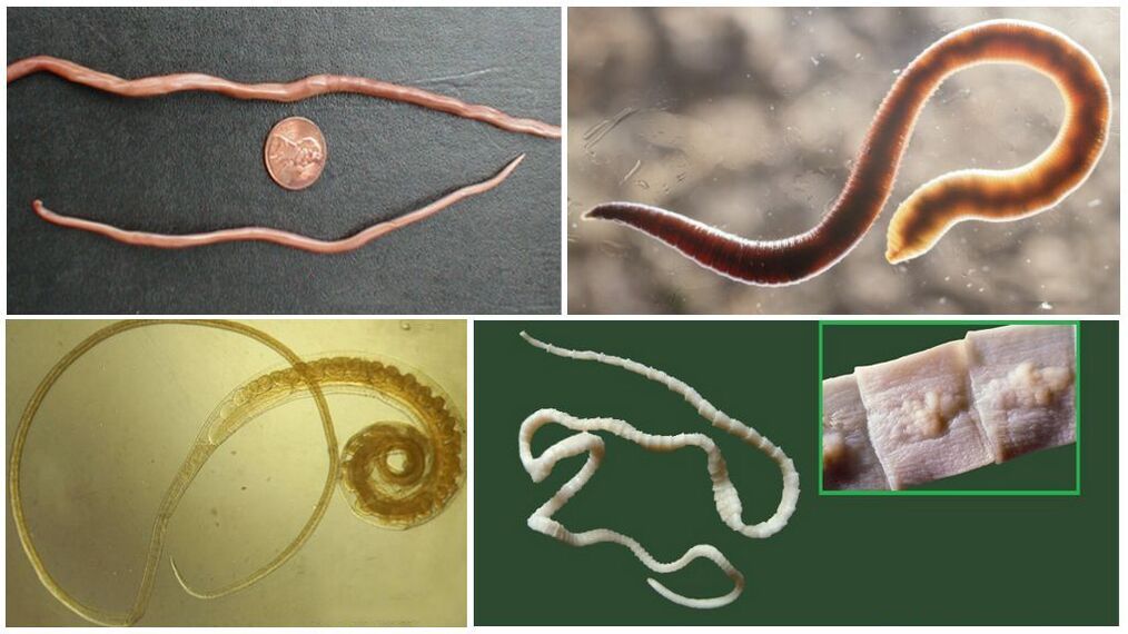 tipos de gusanos en el cuerpo humano