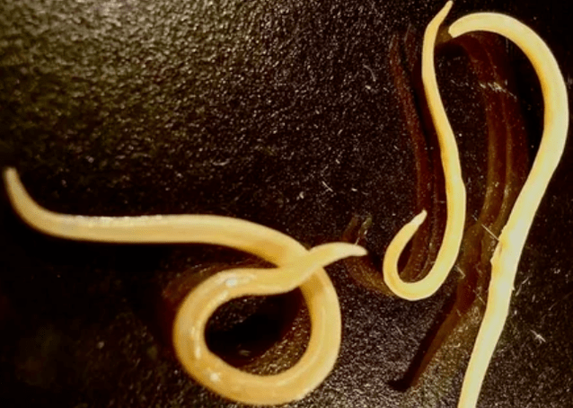 Gusanos protozoarios