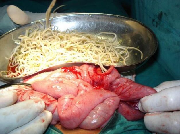 parásitos intestinales