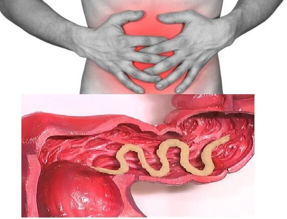 Parásitos en el intestino humano